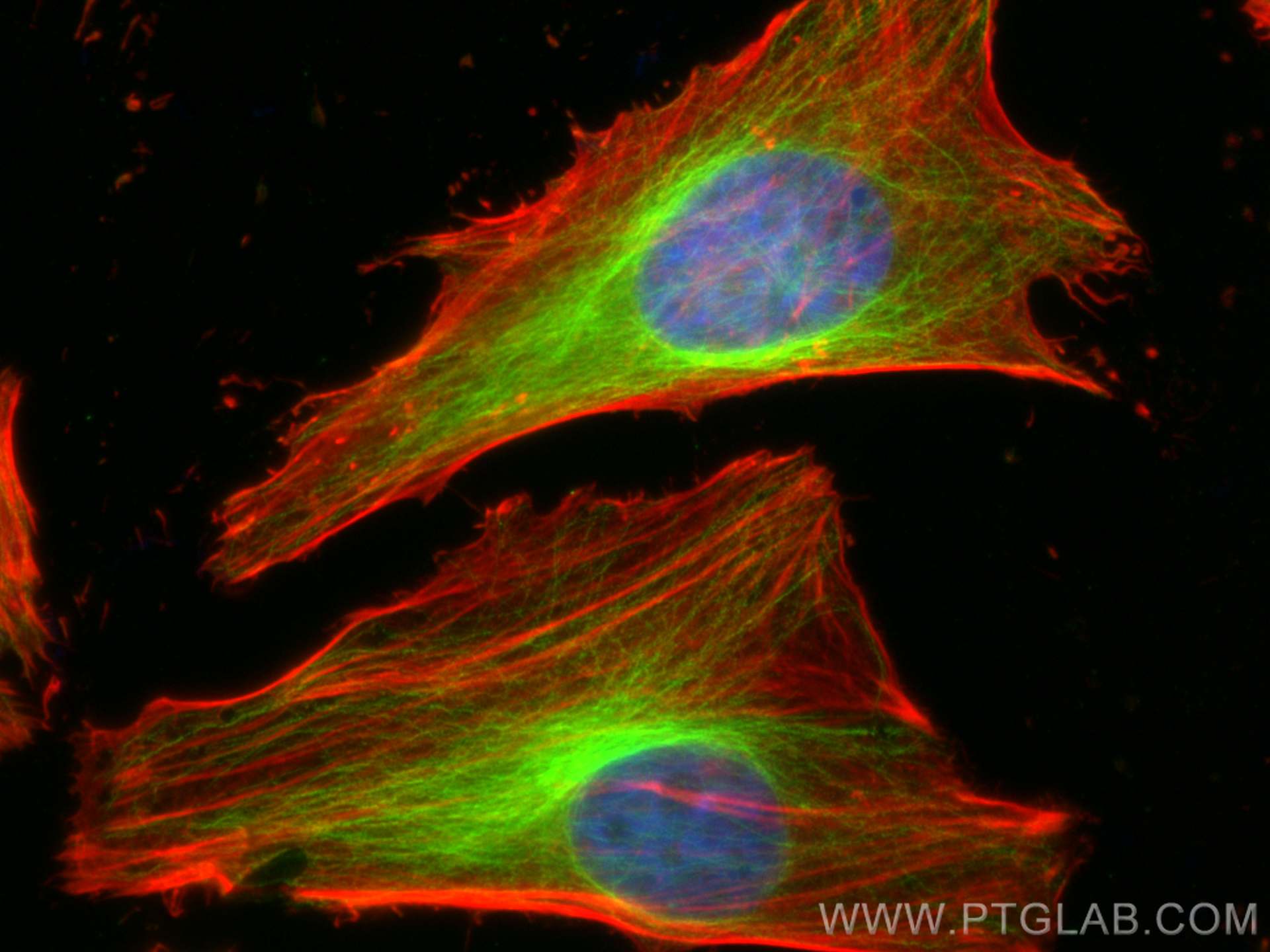 Immunofluorescence (IF) / fluorescent staining of HeLa cells using Alpha Tubulin Polyclonal antibody (14555-1-AP)