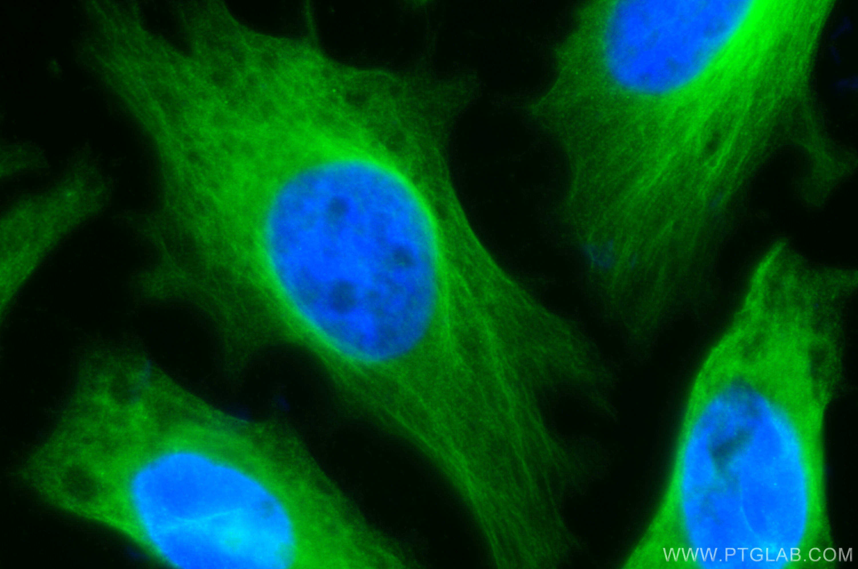Immunofluorescence (IF) / fluorescent staining of HeLa cells using Beta Tubulin Polyclonal antibody (10094-1-AP)