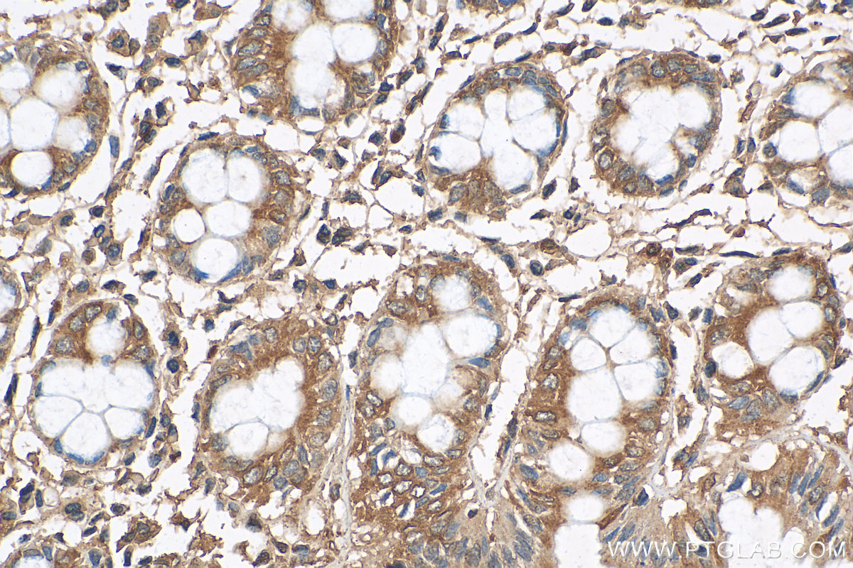Immunohistochemistry (IHC) staining of human colon tissue using Beta Tubulin Polyclonal antibody (10094-1-AP)