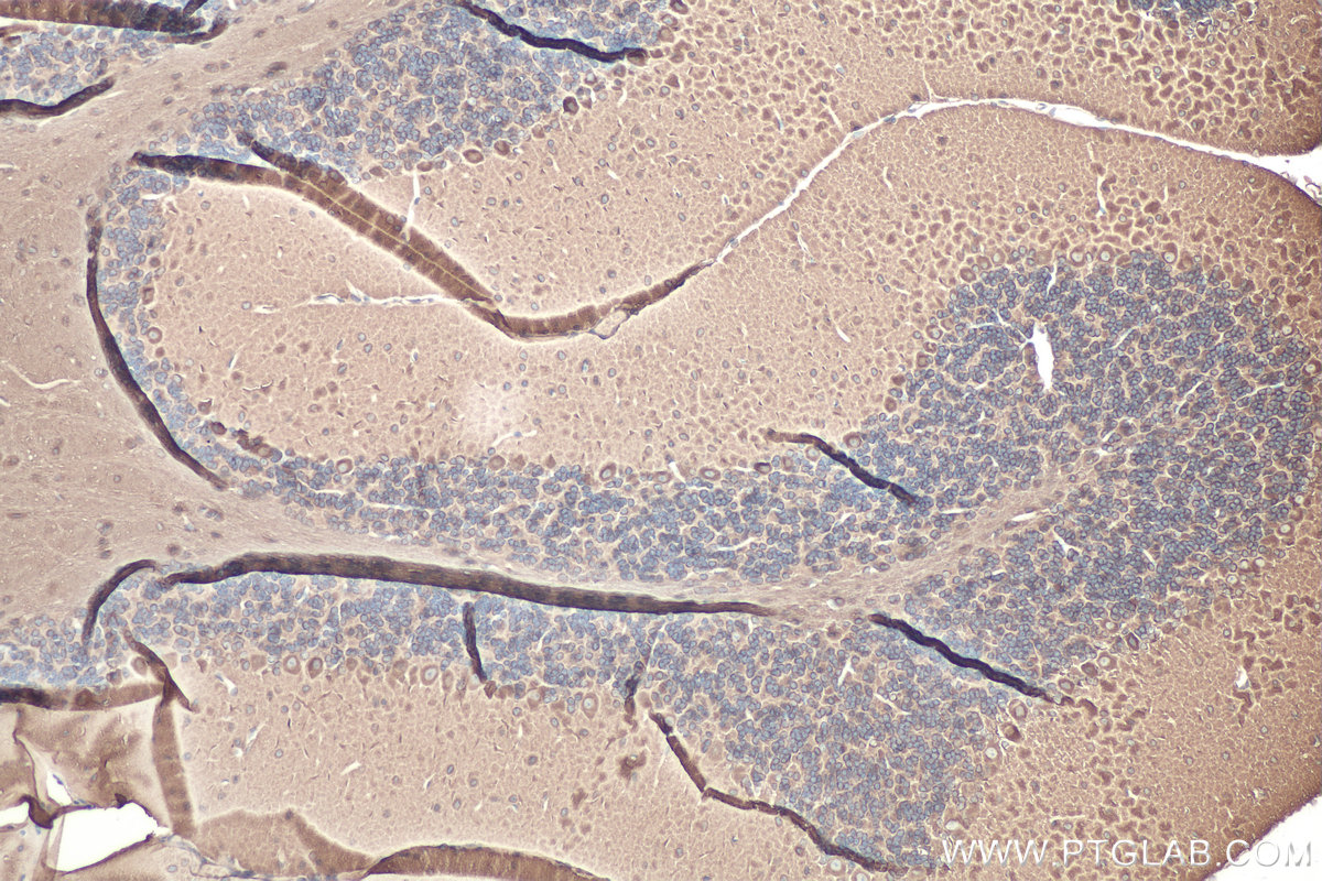 Immunohistochemistry (IHC) staining of mouse cerebellum tissue using Beta Tubulin Polyclonal antibody (10063-2-AP)