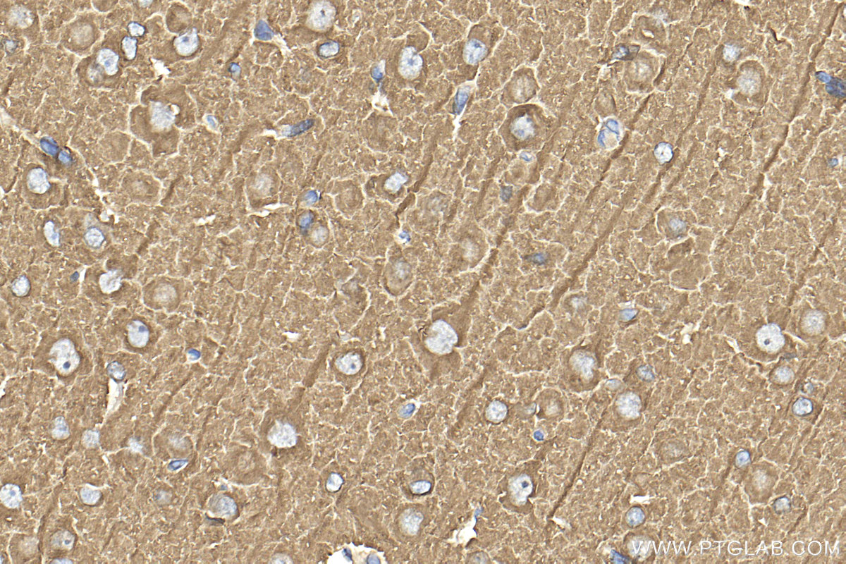 Immunohistochemistry (IHC) staining of rat brain tissue using Beta Tubulin Polyclonal antibody (10068-1-AP)