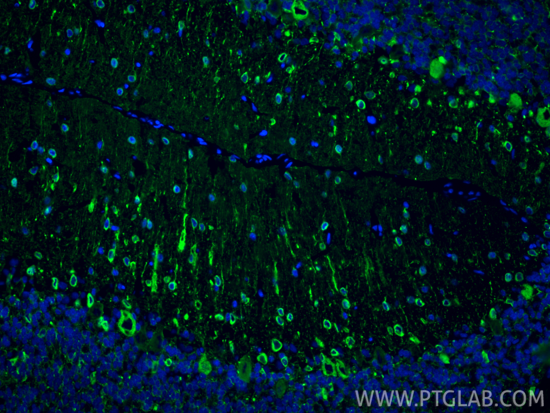 Immunofluorescence (IF) / fluorescent staining of rat cerebellum tissue using TUBB3-specific/TUJ1 Monoclonal antibody (66375-1-Ig)