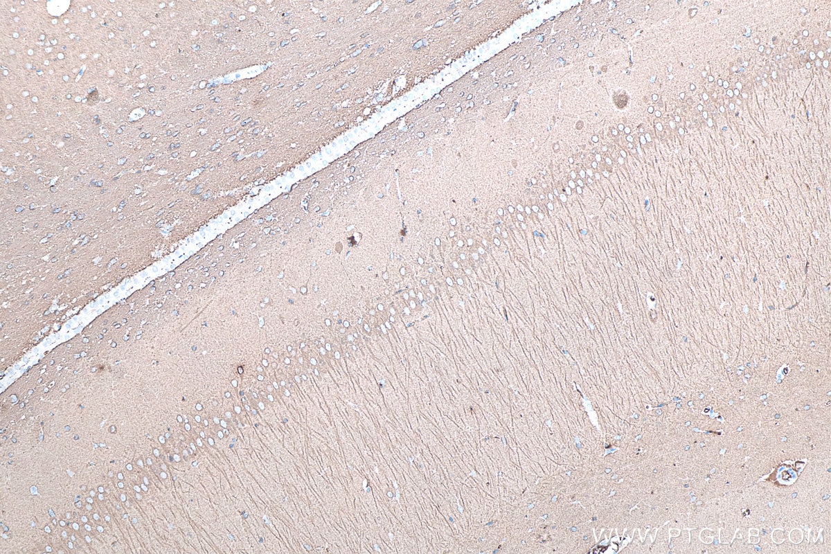 Immunohistochemistry (IHC) staining of rat brain tissue using TUBB3-specific/TUJ1 Monoclonal antibody (66375-1-Ig)
