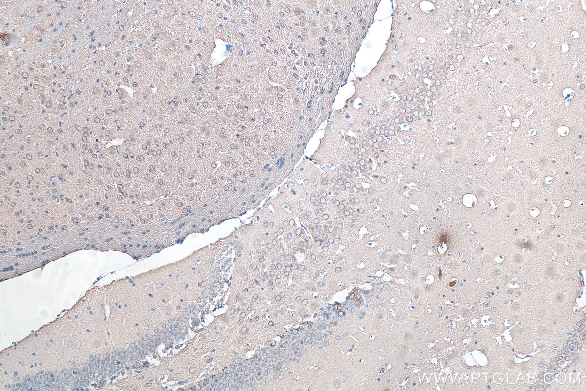 Immunohistochemistry (IHC) staining of mouse brain tissue using TUBB3-specific/TUJ1 Monoclonal antibody (66375-1-Ig)