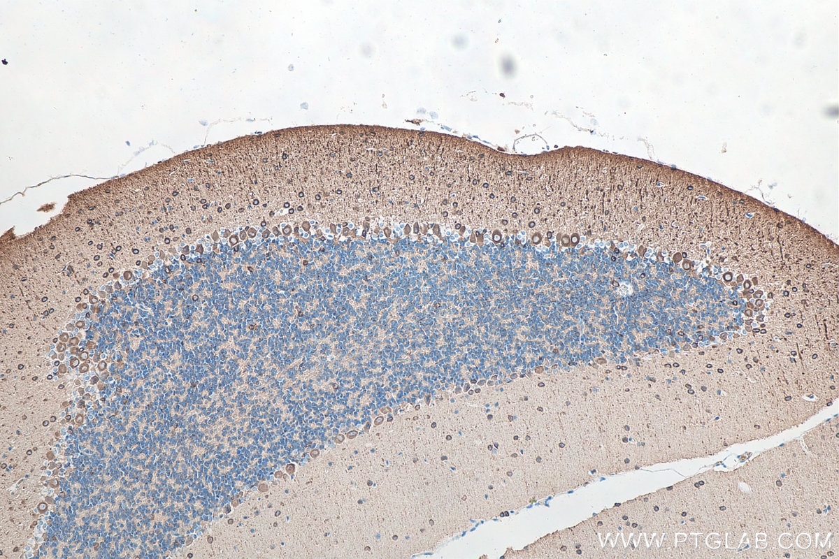 Immunohistochemistry (IHC) staining of mouse cerebellum tissue using TUBB3-specific/TUJ1 Monoclonal antibody (66375-1-Ig)