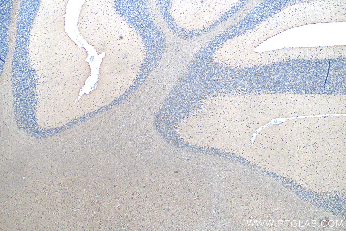 Immunohistochemistry (IHC) staining of rat cerebellum tissue using TUBB3-specific/TUJ1 Monoclonal antibody (66375-1-Ig)