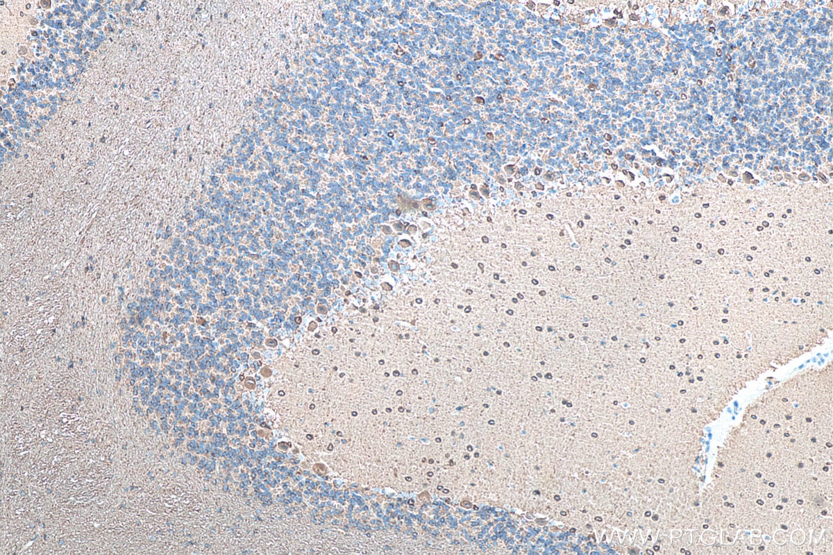 Immunohistochemistry (IHC) staining of rat cerebellum tissue using TUBB3-specific/TUJ1 Monoclonal antibody (66375-1-Ig)
