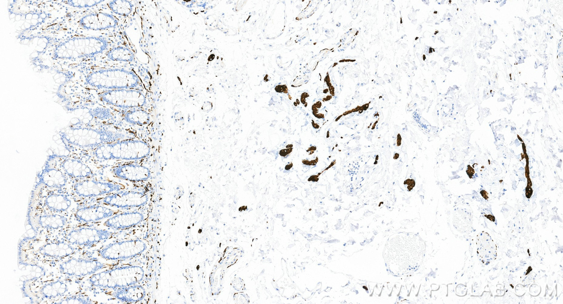 Immunohistochemistry (IHC) staining of human colon tissue using TUBB3-specific/TUJ1 Recombinant monoclonal antibod (80128-3-RR)