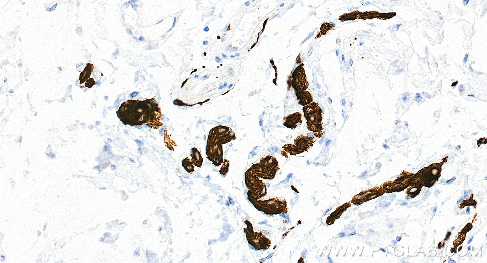 Immunohistochemistry (IHC) staining of human colon tissue using TUBB3-specific/TUJ1 Recombinant monoclonal antibod (80128-3-RR)