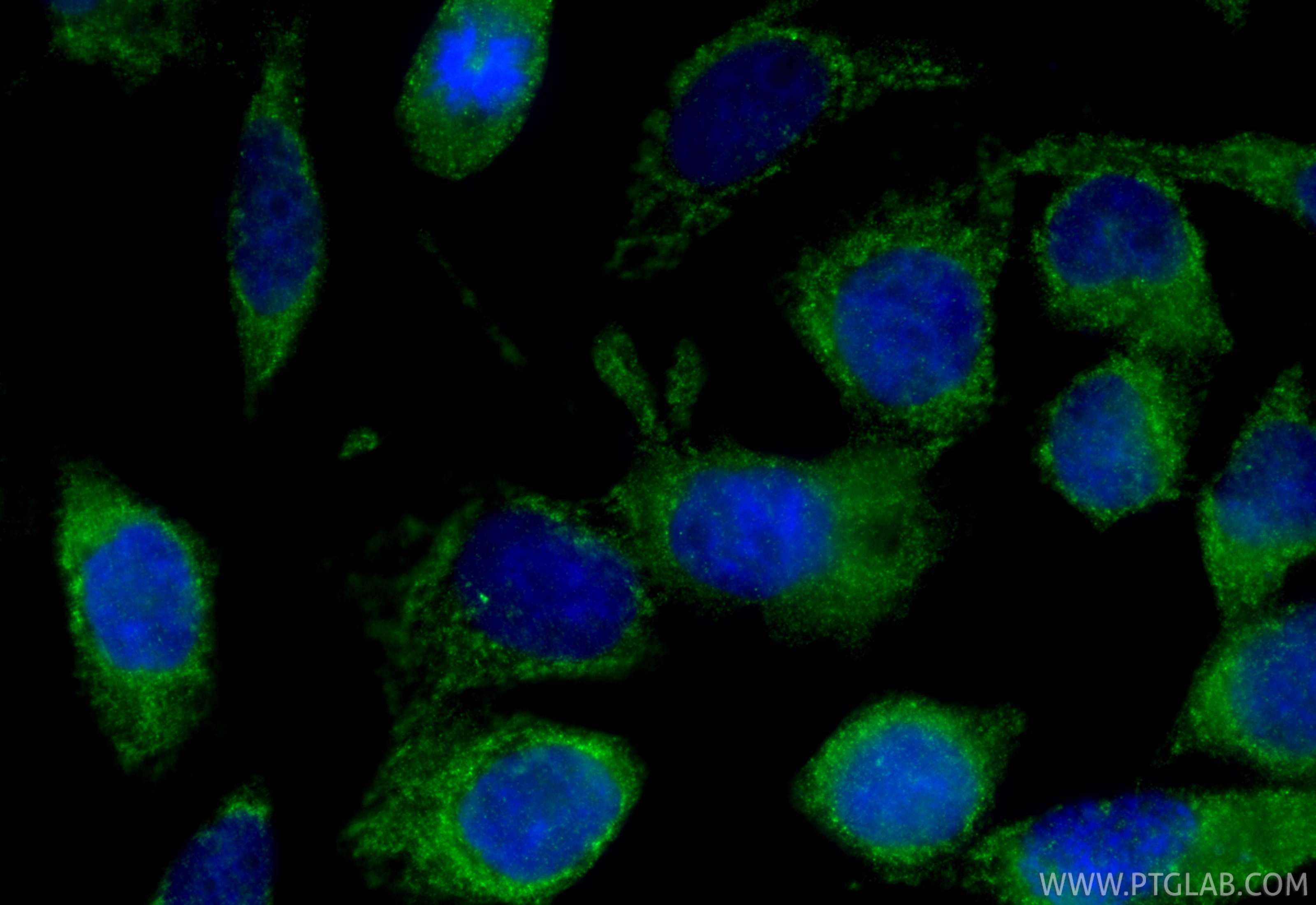 Immunofluorescence (IF) / fluorescent staining of A431 cells using Gamma Tubulin Polyclonal antibody (15176-1-AP)