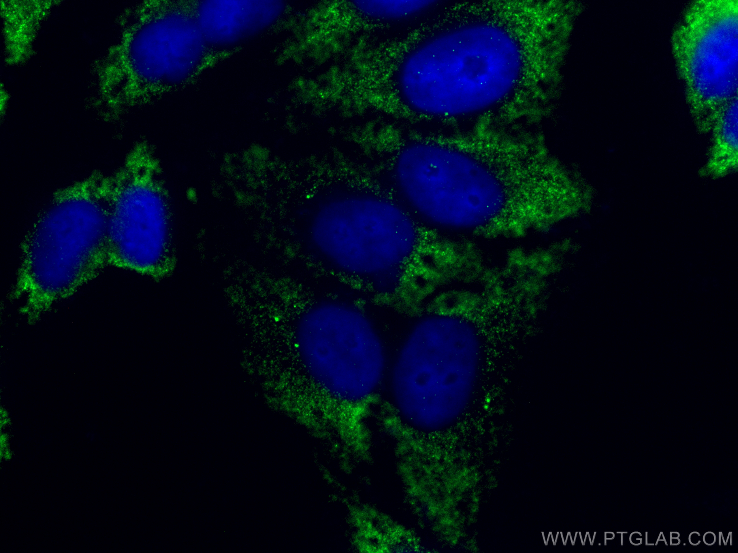 Immunofluorescence (IF) / fluorescent staining of HepG2 cells using TUBG2 Polyclonal antibody (28009-1-AP)