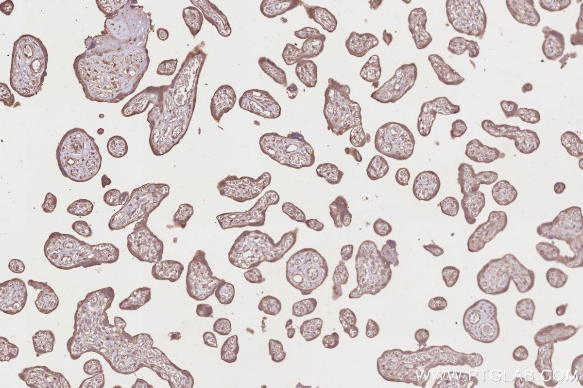 Immunohistochemistry (IHC) staining of human placenta tissue using TUBGCP5 Polyclonal antibody (14620-1-AP)