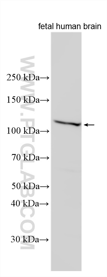 Western Blot (WB) analysis of various lysates using TUBGCP5 Polyclonal antibody (14620-1-AP)