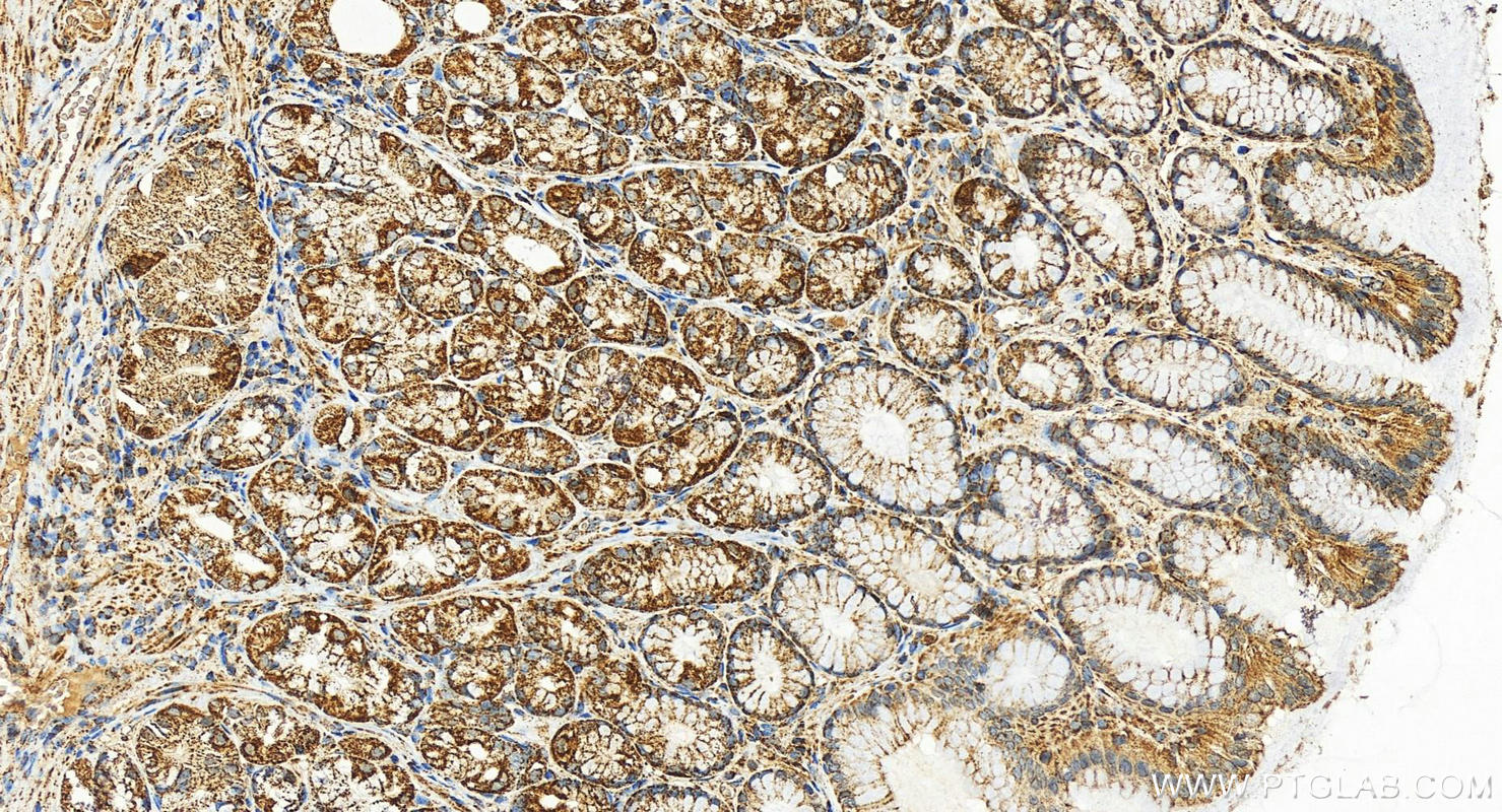 Immunohistochemistry (IHC) staining of human stomach tissue using TUFM Polyclonal antibody (26730-1-AP)