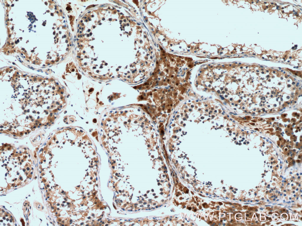 Immunohistochemistry (IHC) staining of human testis tissue using TUFT1 Polyclonal antibody (23385-1-AP)