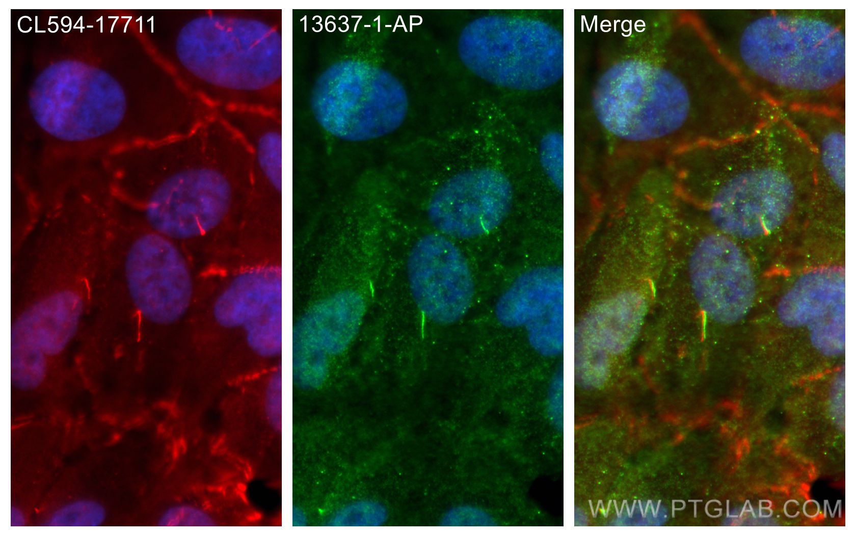 Immunofluorescence (IF) / fluorescent staining of hTERT-RPE1 cells using TULP3 Polyclonal antibody (13637-1-AP)