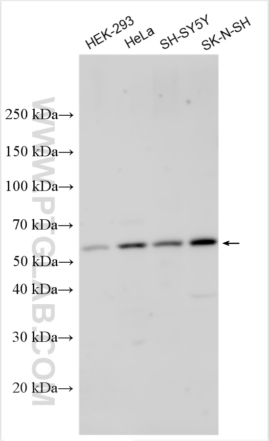 Western Blot (WB) analysis of various lysates using TULP3 Polyclonal antibody (13637-1-AP)