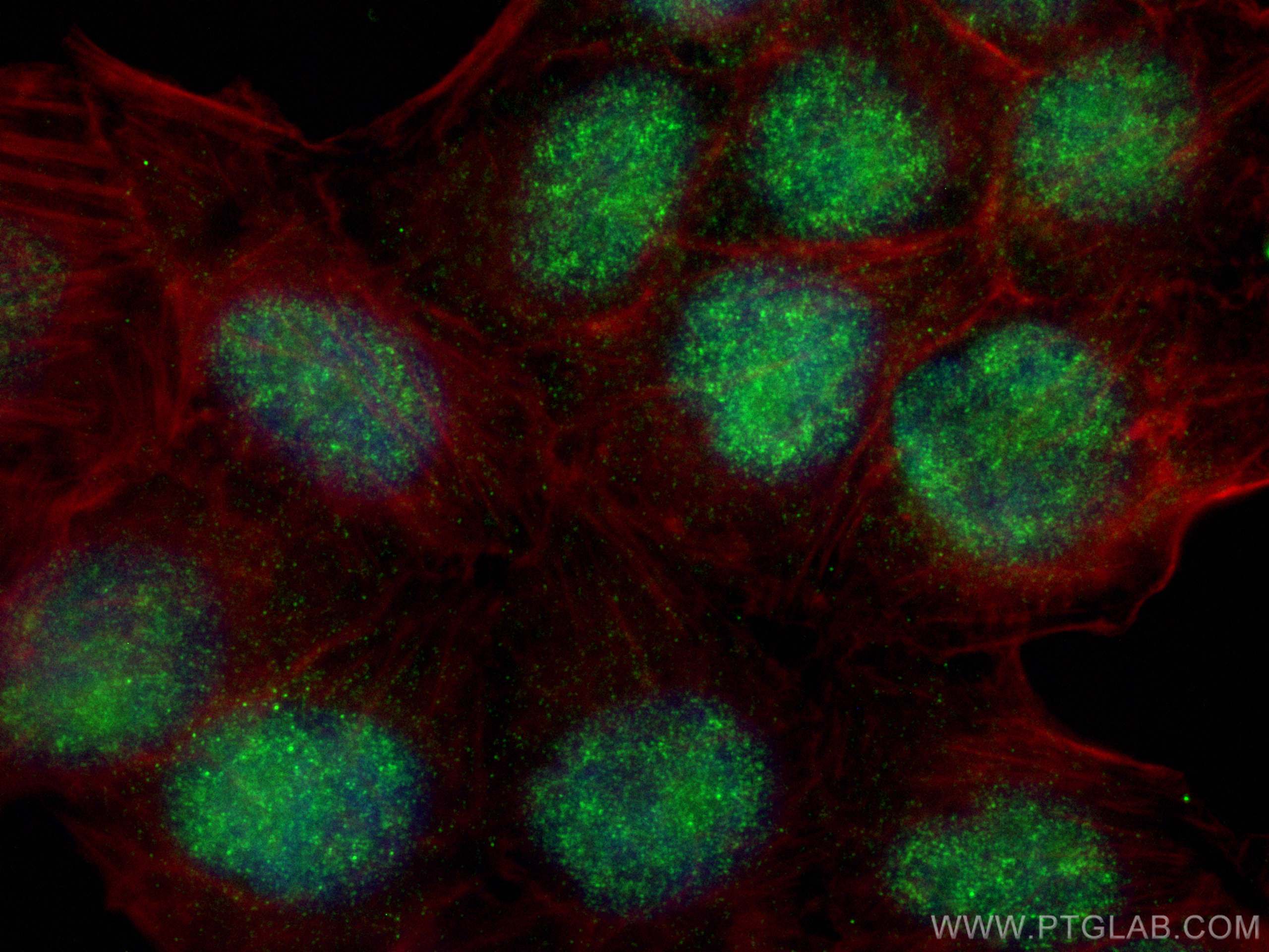 Immunofluorescence (IF) / fluorescent staining of L02 cells using TWIST1-specific Polyclonal antibody (25465-1-AP)