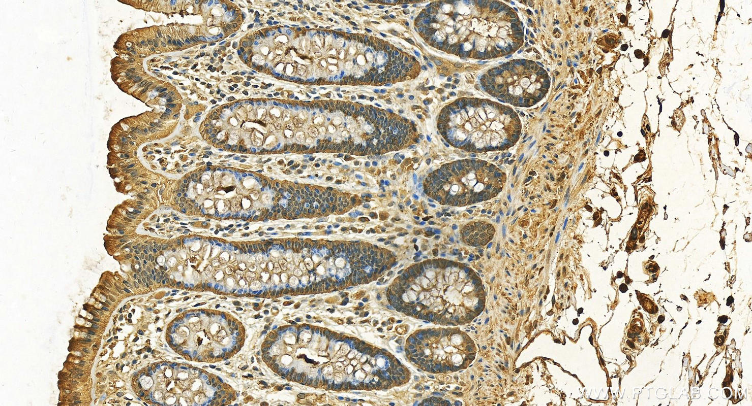 Immunohistochemistry (IHC) staining of human normal colon using Thioredoxin Polyclonal antibody (14999-1-AP)