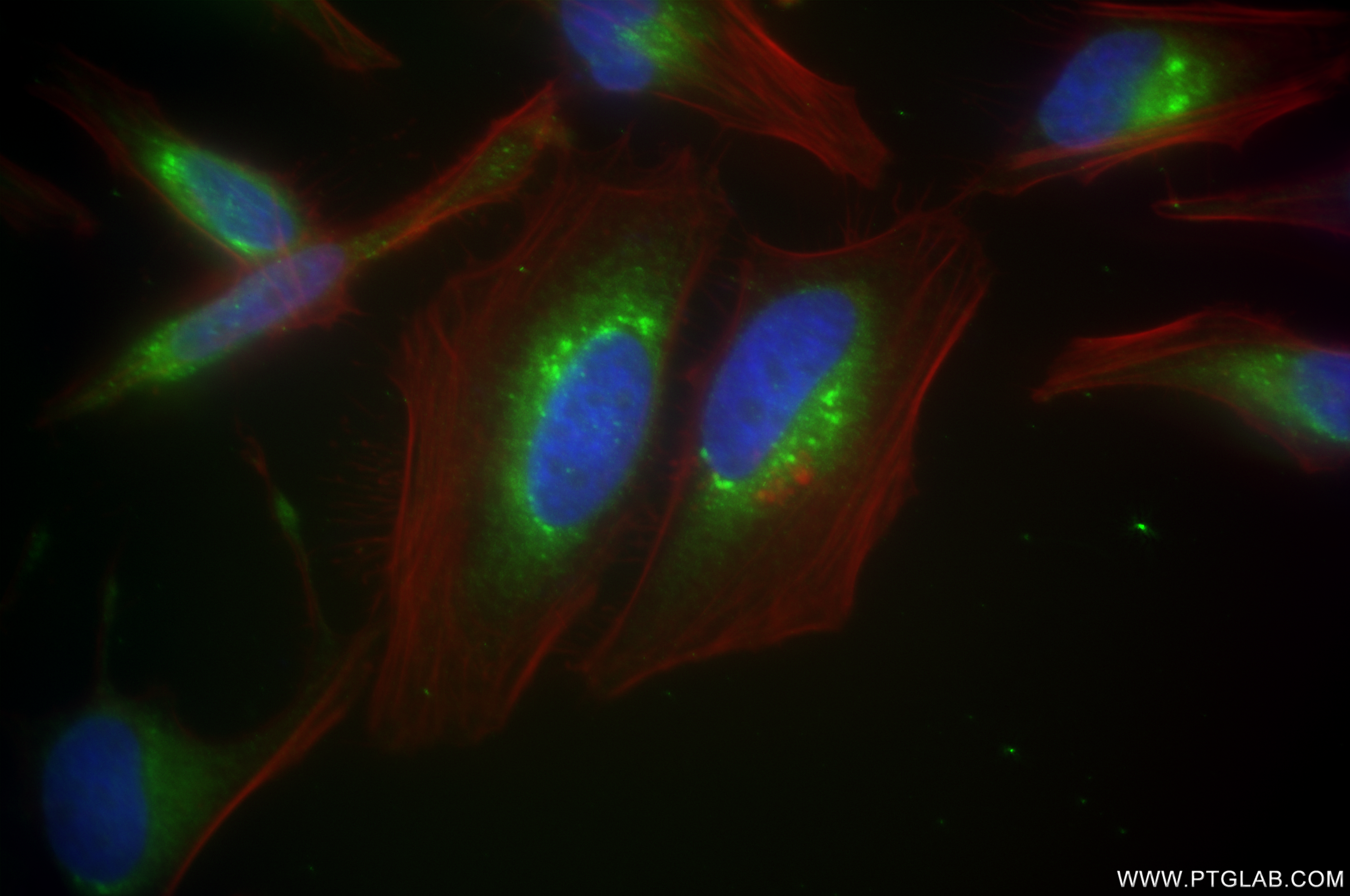 Immunofluorescence (IF) / fluorescent staining of HeLa cells using TXNDC5 Recombinant antibody (84756-5-RR)