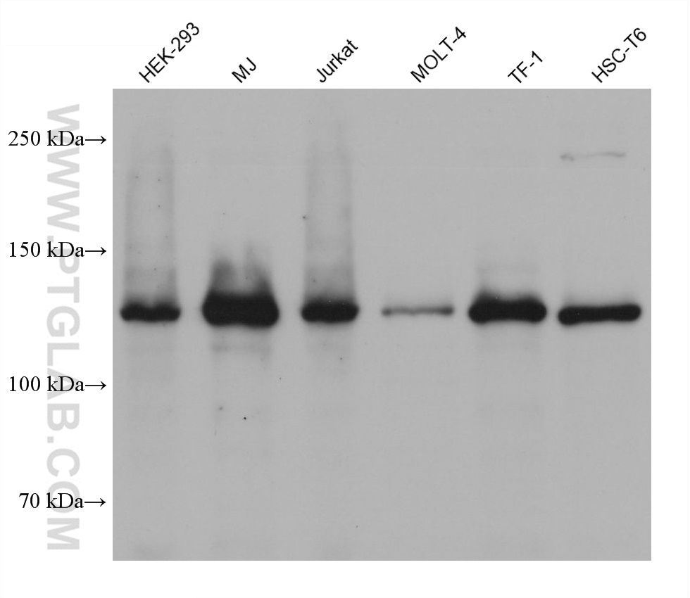 Western Blot (WB) analysis of various lysates using TYK2 Monoclonal antibody (67411-1-Ig)