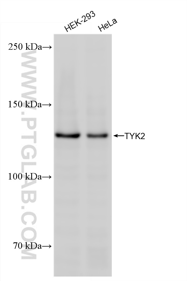 Western Blot (WB) analysis of various lysates using TYK2 Recombinant antibody (83161-4-RR)