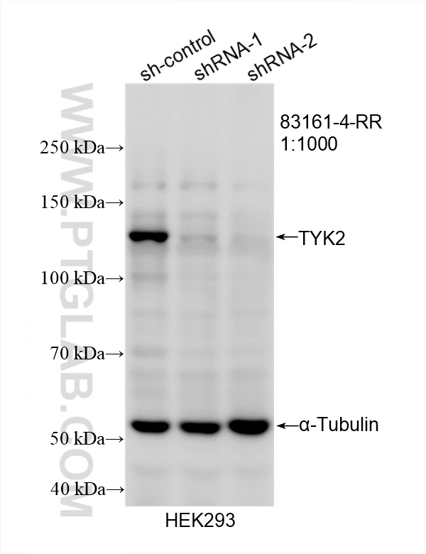 Western Blot (WB) analysis of HEK-293 cells using TYK2 Recombinant antibody (83161-4-RR)