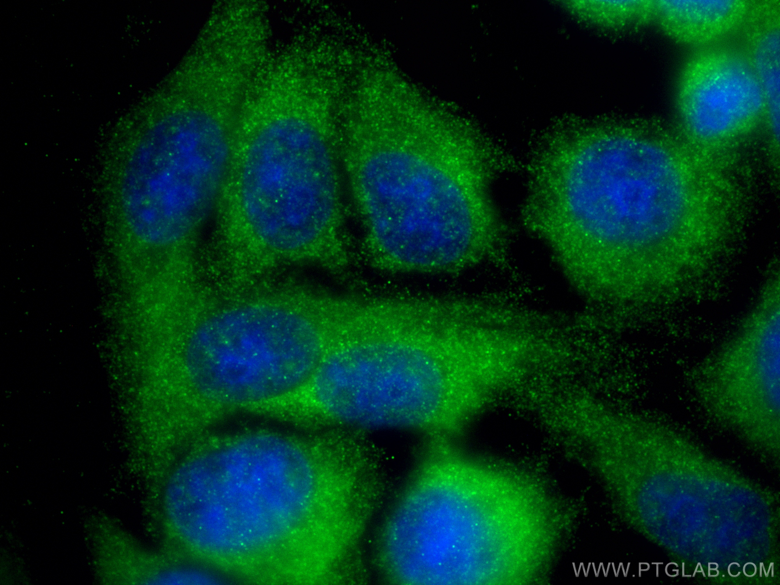 Immunofluorescence (IF) / fluorescent staining of HepG2 cells using TYK2 Recombinant antibody (83161-5-RR)