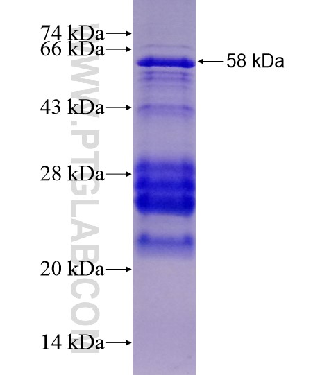 TYK2 fusion protein Ag28457 SDS-PAGE