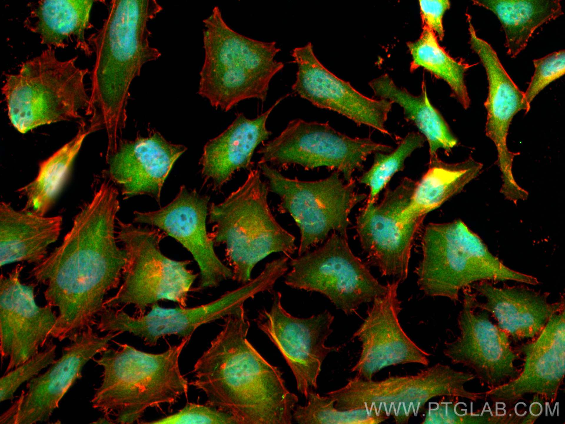 Immunofluorescence (IF) / fluorescent staining of HeLa cells using Thymidylate synthase Polyclonal antibody (15047-1-AP)