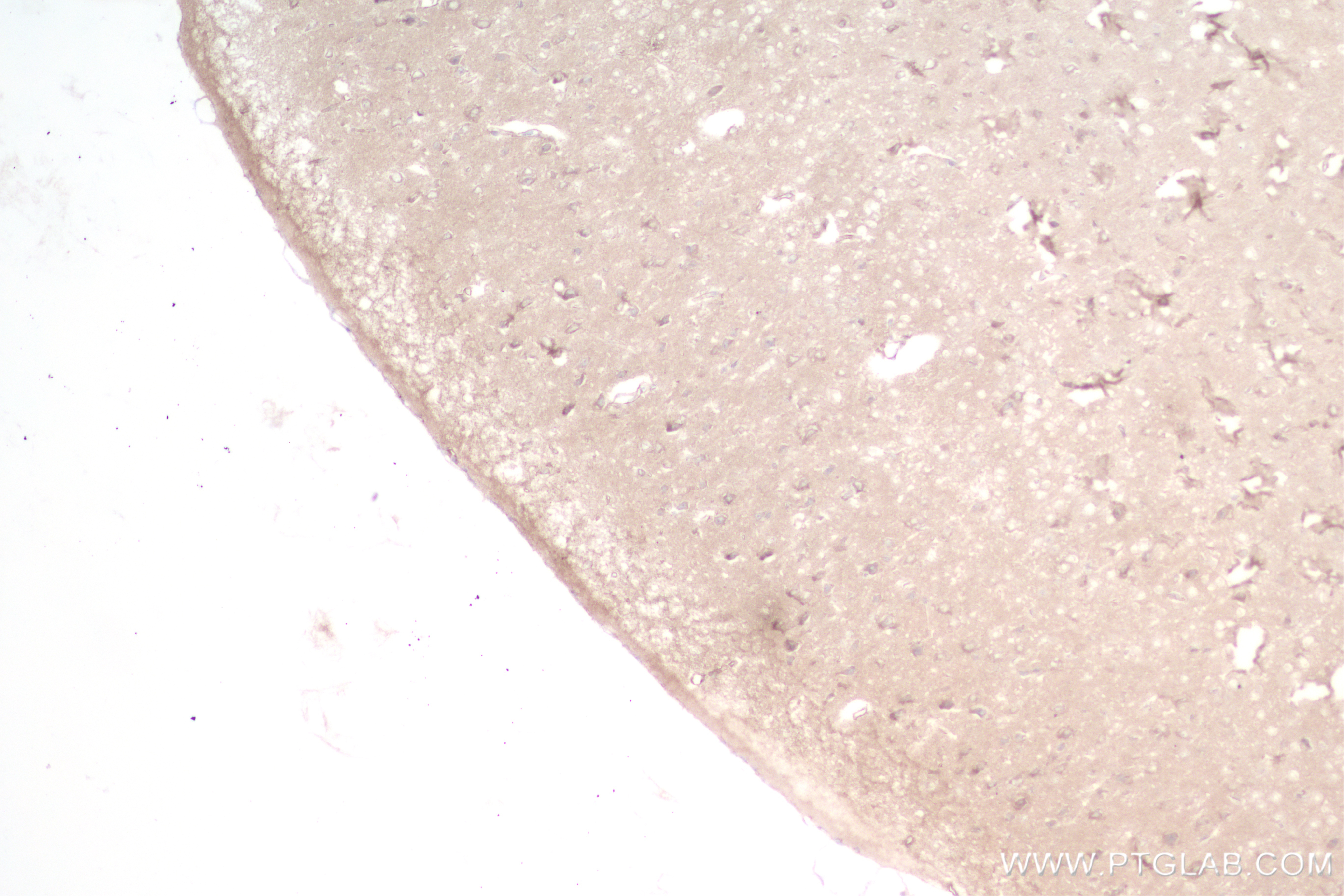 Immunohistochemistry (IHC) staining of mouse brain tissue using TYRO3 Recombinant antibody (84929-6-RR)