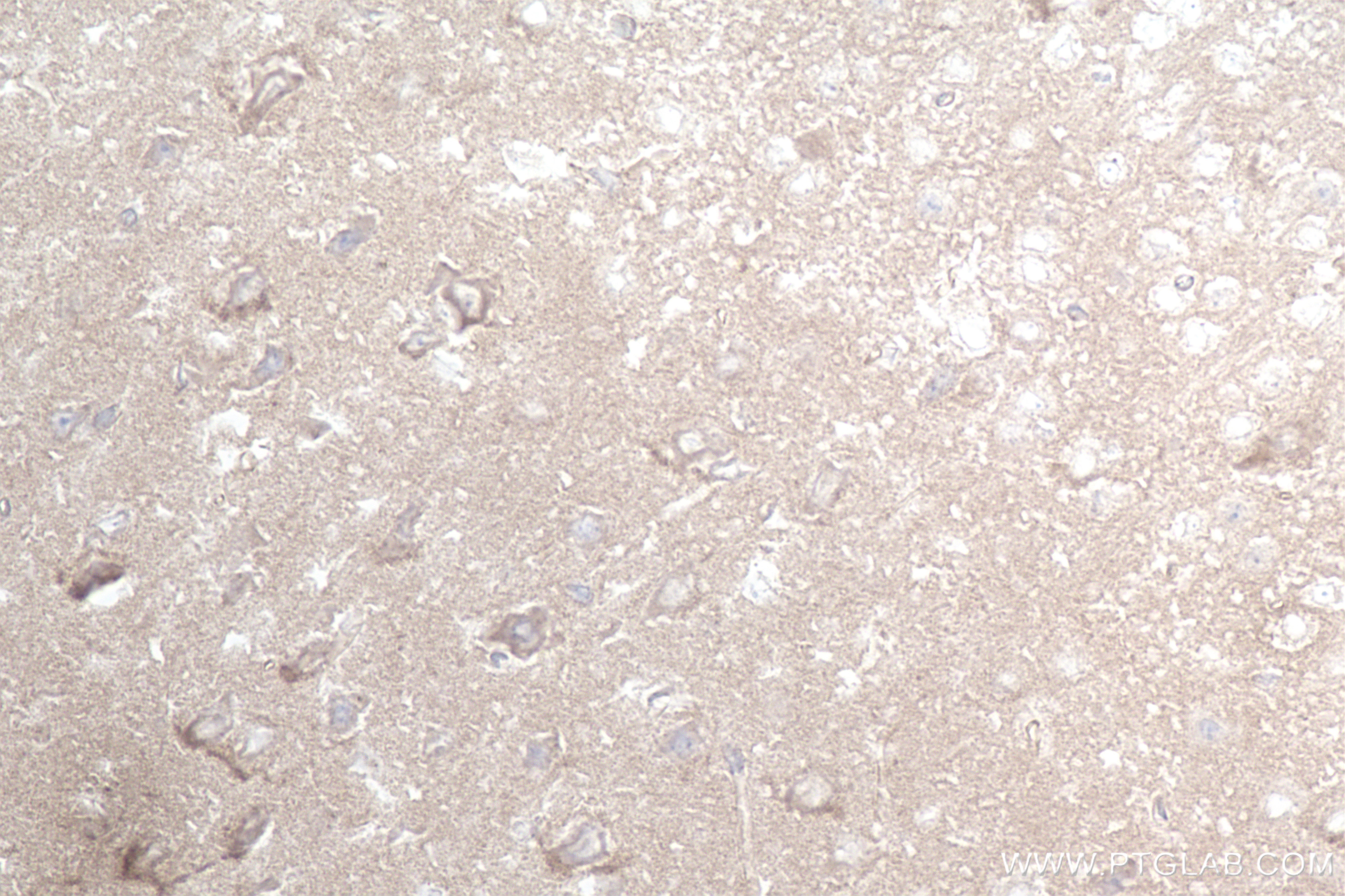 Immunohistochemistry (IHC) staining of mouse brain tissue using TYRO3 Recombinant antibody (84929-6-RR)