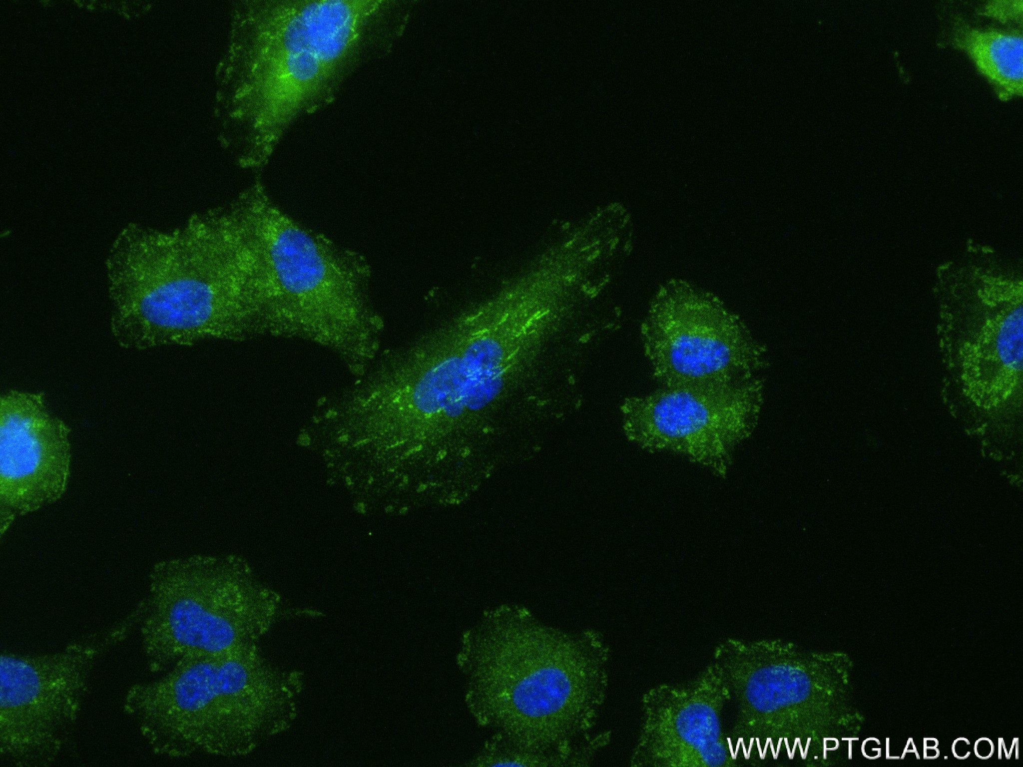 Immunofluorescence (IF) / fluorescent staining of A549 cells using Talin-1 Recombinant antibody (82856-18-RR)