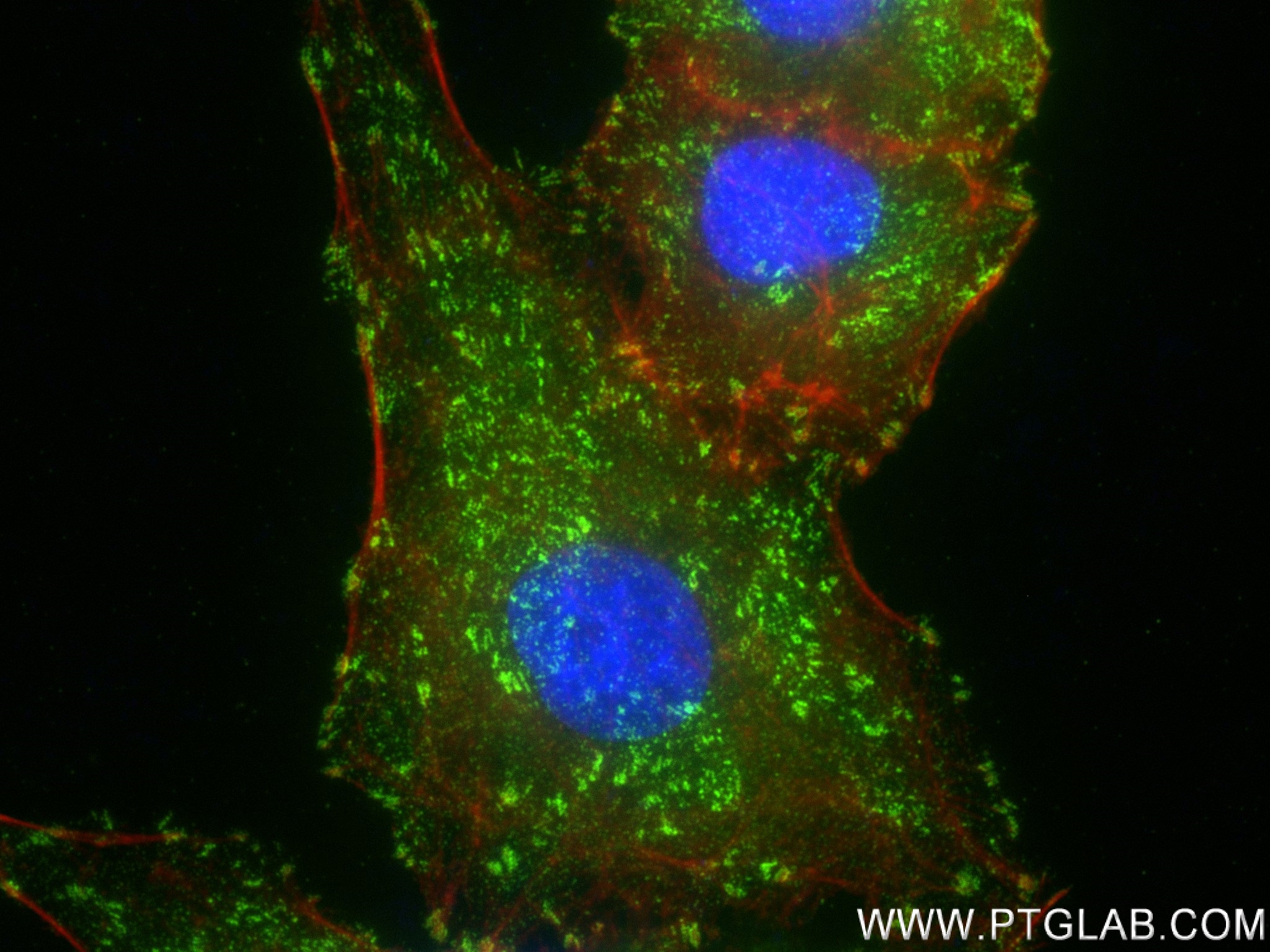 Immunofluorescence (IF) / fluorescent staining of A549 cells using Talin-1 Recombinant antibody (82856-18-RR)