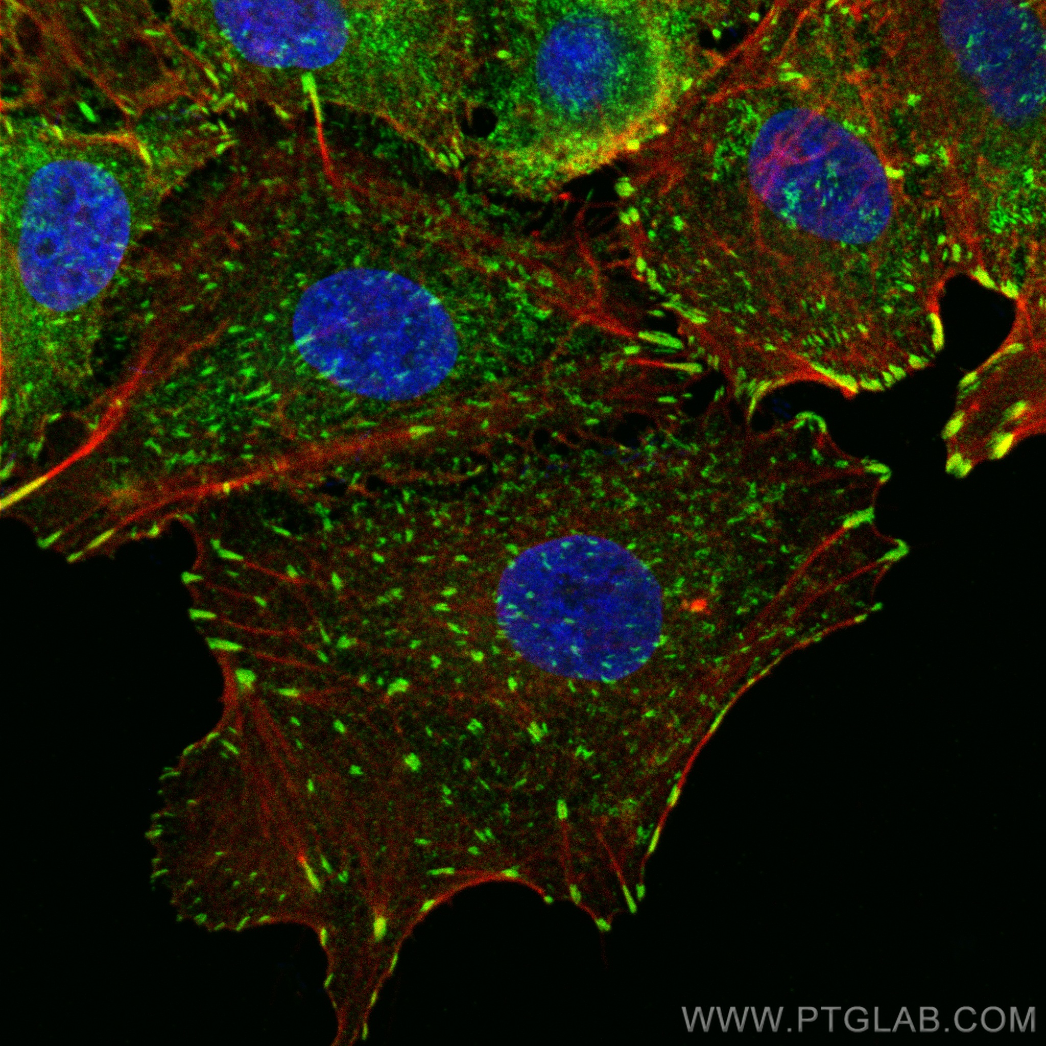 Immunofluorescence (IF) / fluorescent staining of A549 cells using Talin-1 Recombinant antibody (82856-18-RR)