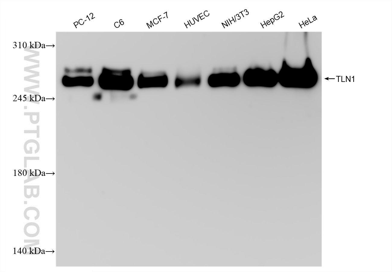 Western Blot (WB) analysis of various lysates using Talin-1 Recombinant antibody (82856-18-RR)