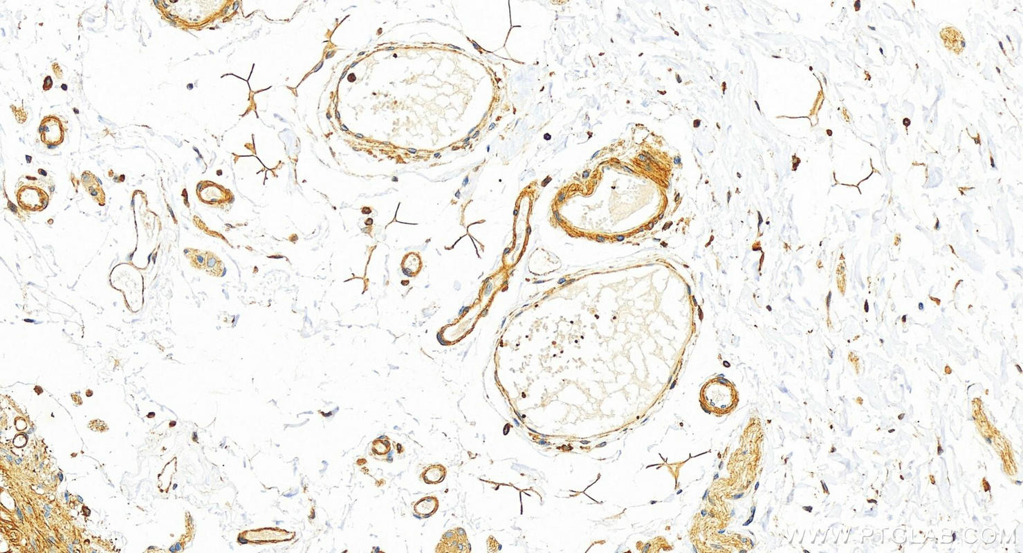 Immunohistochemistry (IHC) staining of human colon tissue using Talin-1 Recombinant antibody (82856-4-RR)