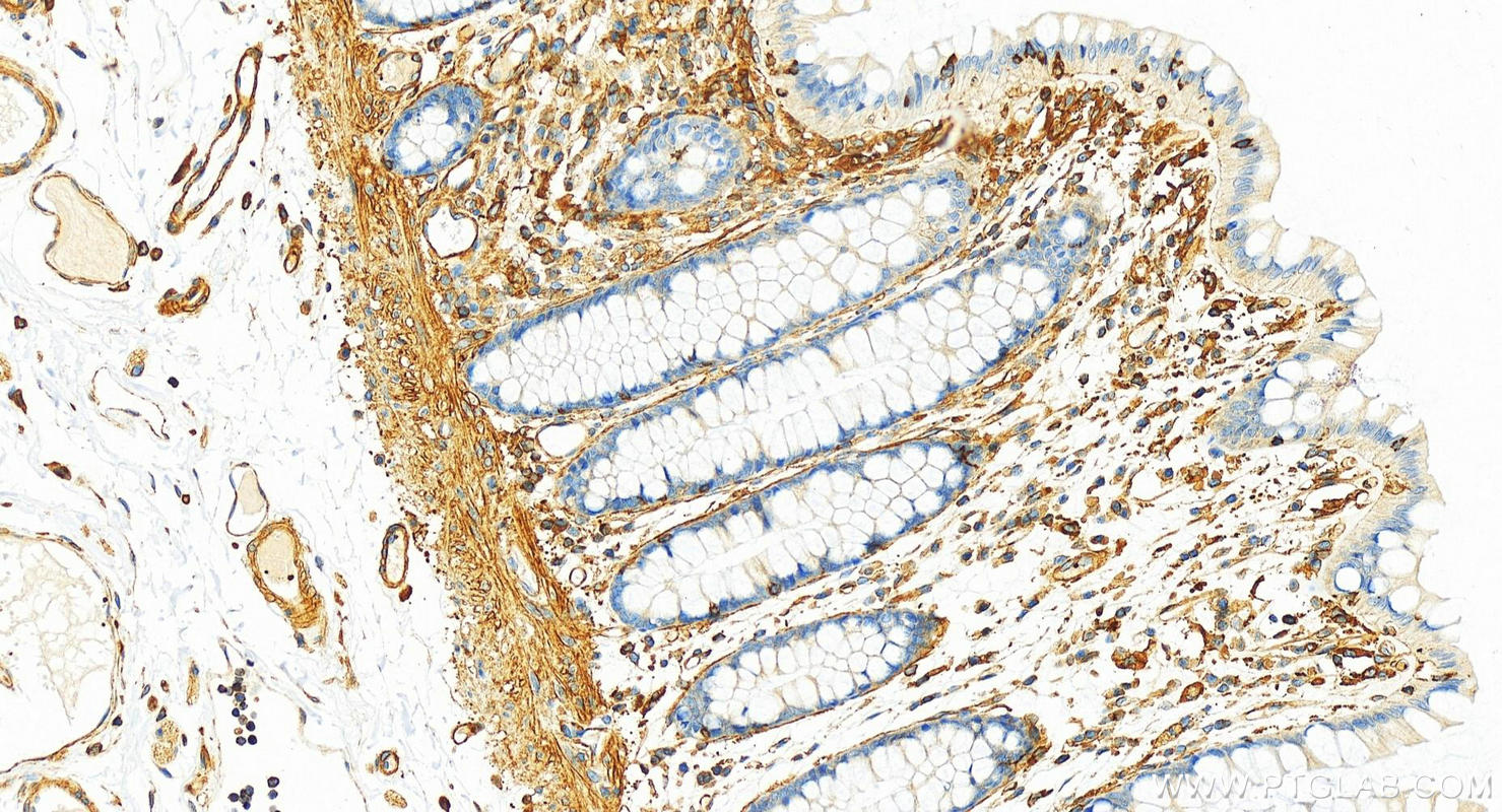 Immunohistochemistry (IHC) staining of human colon tissue using Talin-1 Recombinant antibody (82856-4-RR)