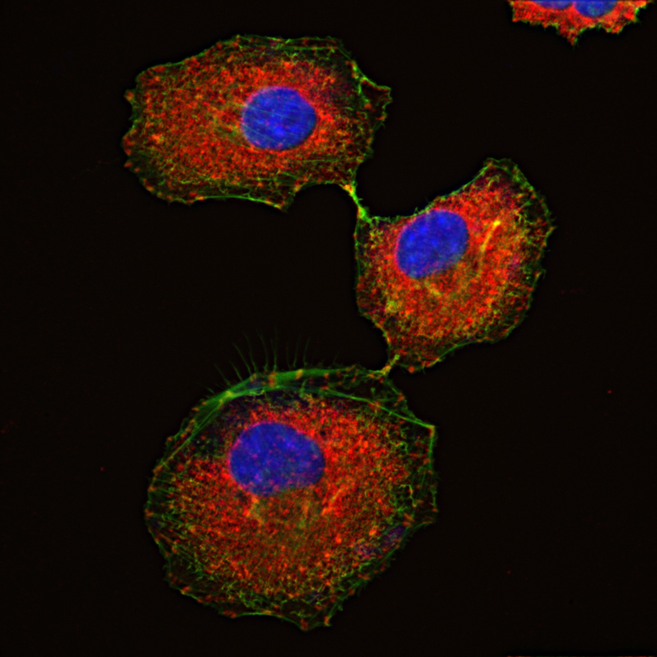 Immunofluorescence (IF) / fluorescent staining of A549 cells using Talin-1 Recombinant antibody (82856-4-RR)