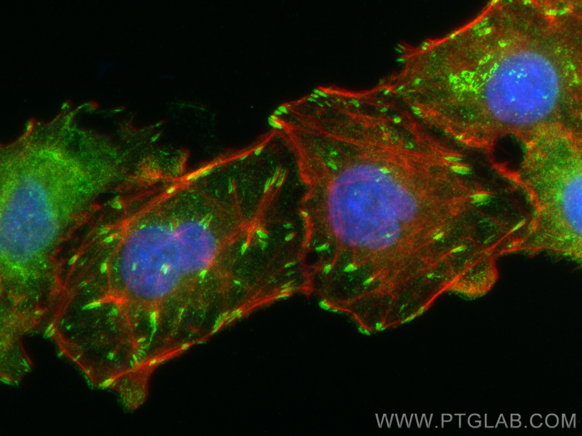 Immunofluorescence (IF) / fluorescent staining of A549 cells using Talin-1 Recombinant antibody (82856-4-RR)