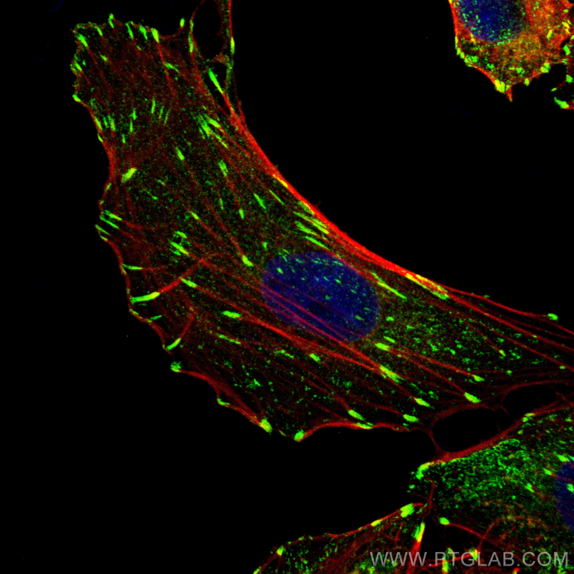 Immunofluorescence (IF) / fluorescent staining of A549 cells using Talin-1 Recombinant antibody (82856-4-RR)