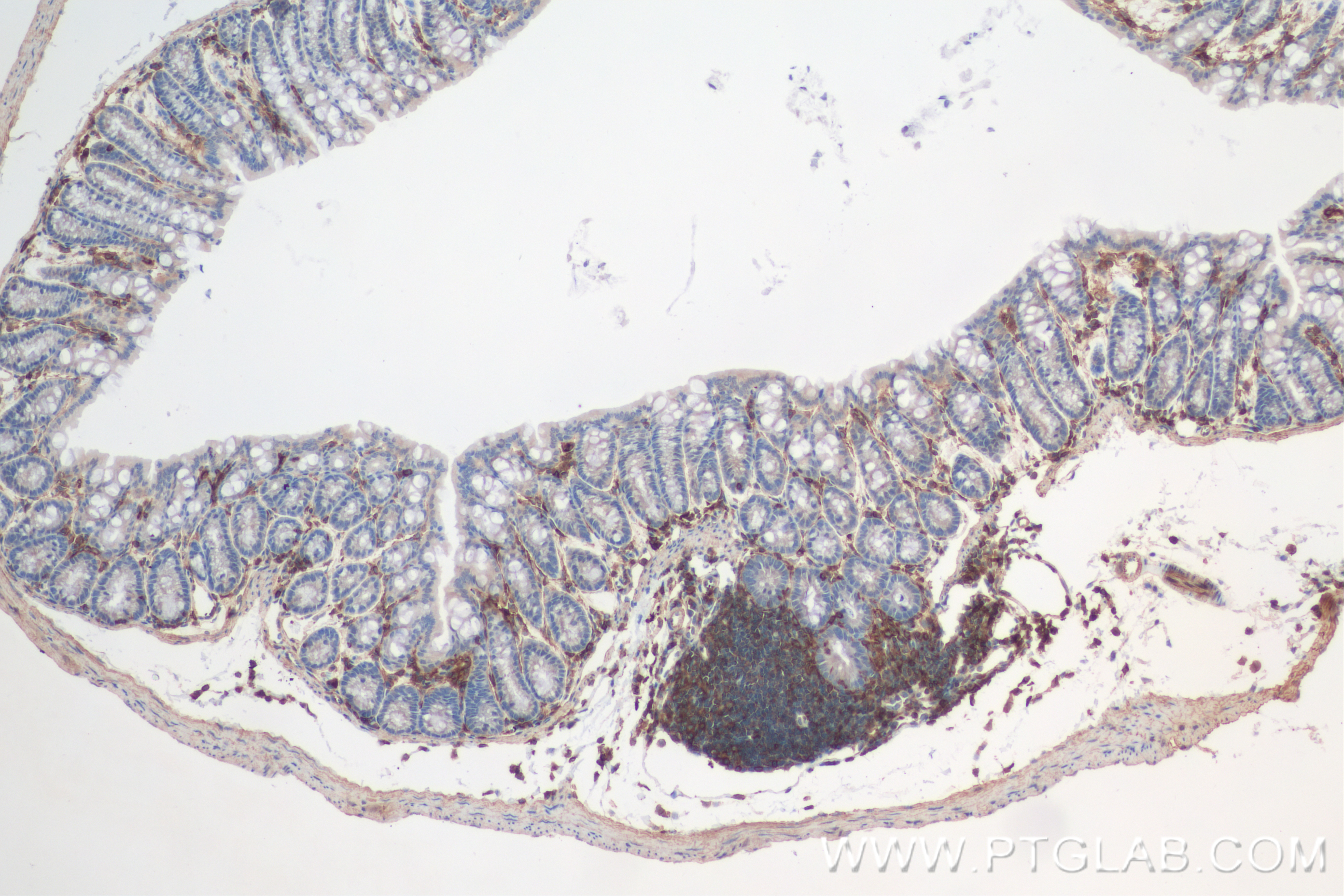 Immunohistochemistry (IHC) staining of mouse colon tissue using Talin-1 Recombinant antibody (82856-4-RR)