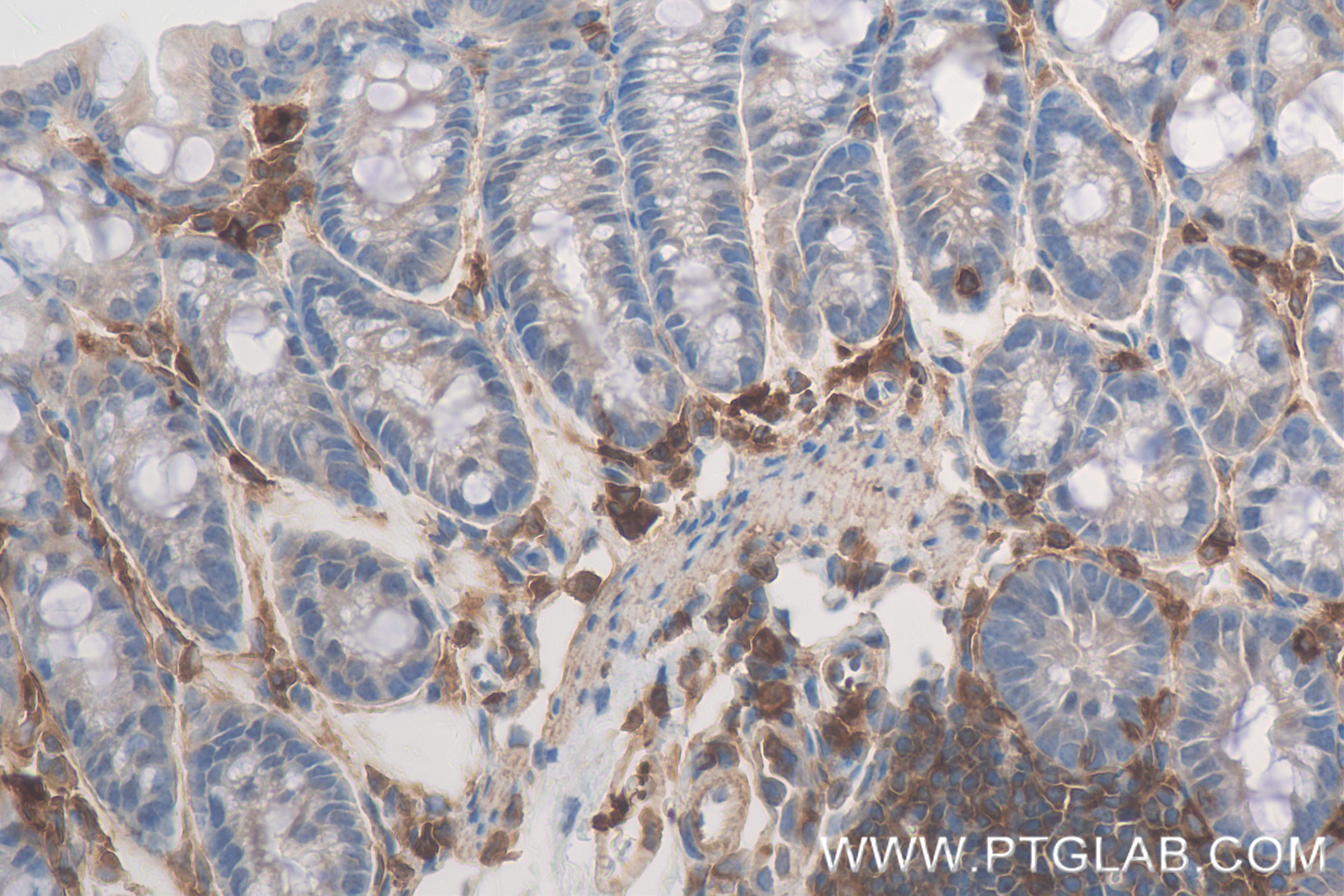 Immunohistochemistry (IHC) staining of mouse colon tissue using Talin-1 Recombinant antibody (82856-4-RR)