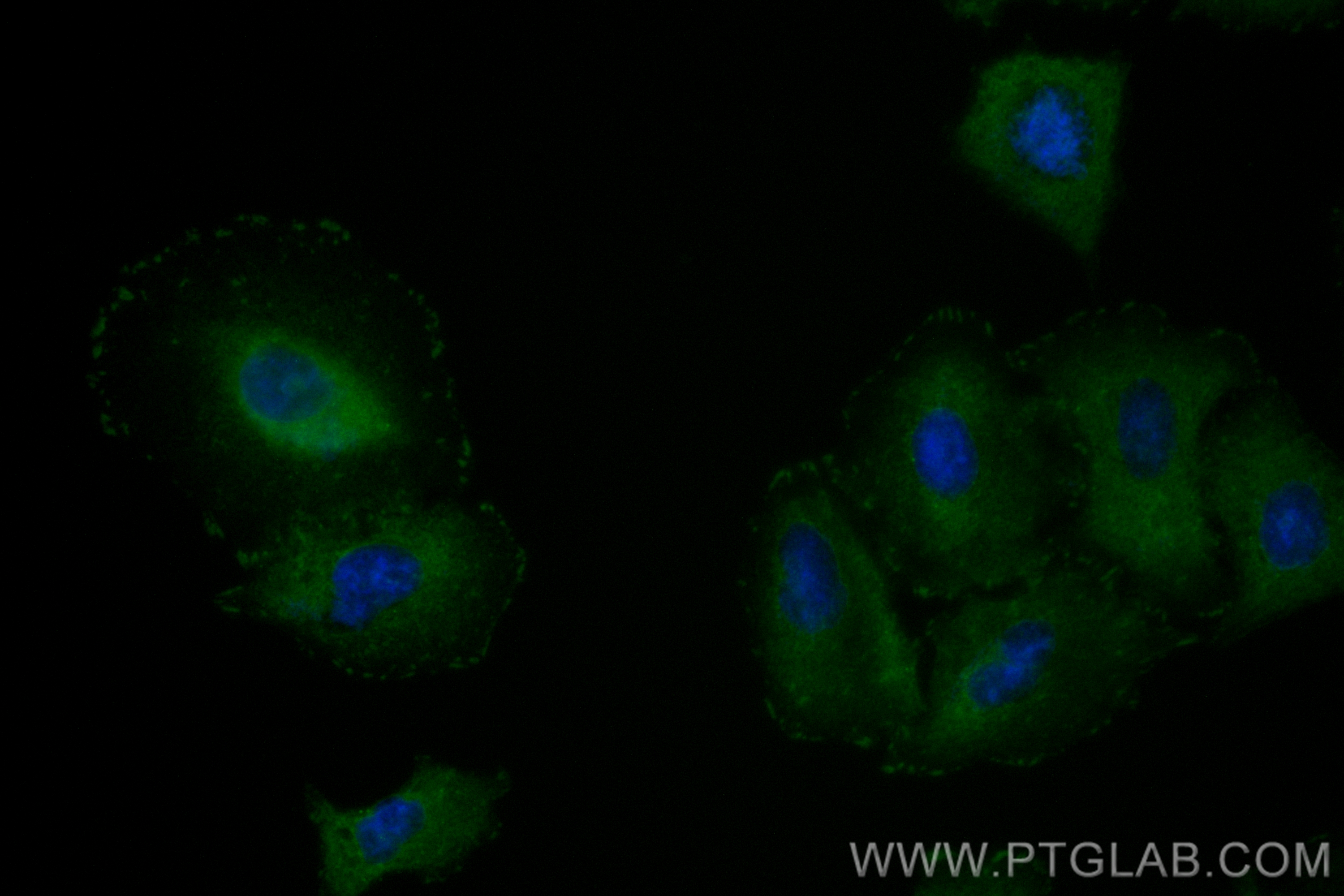 Immunofluorescence (IF) / fluorescent staining of A549 cells using CoraLite® Plus 488-conjugated Talin-1 Recombinant  (CL488-82856-18)