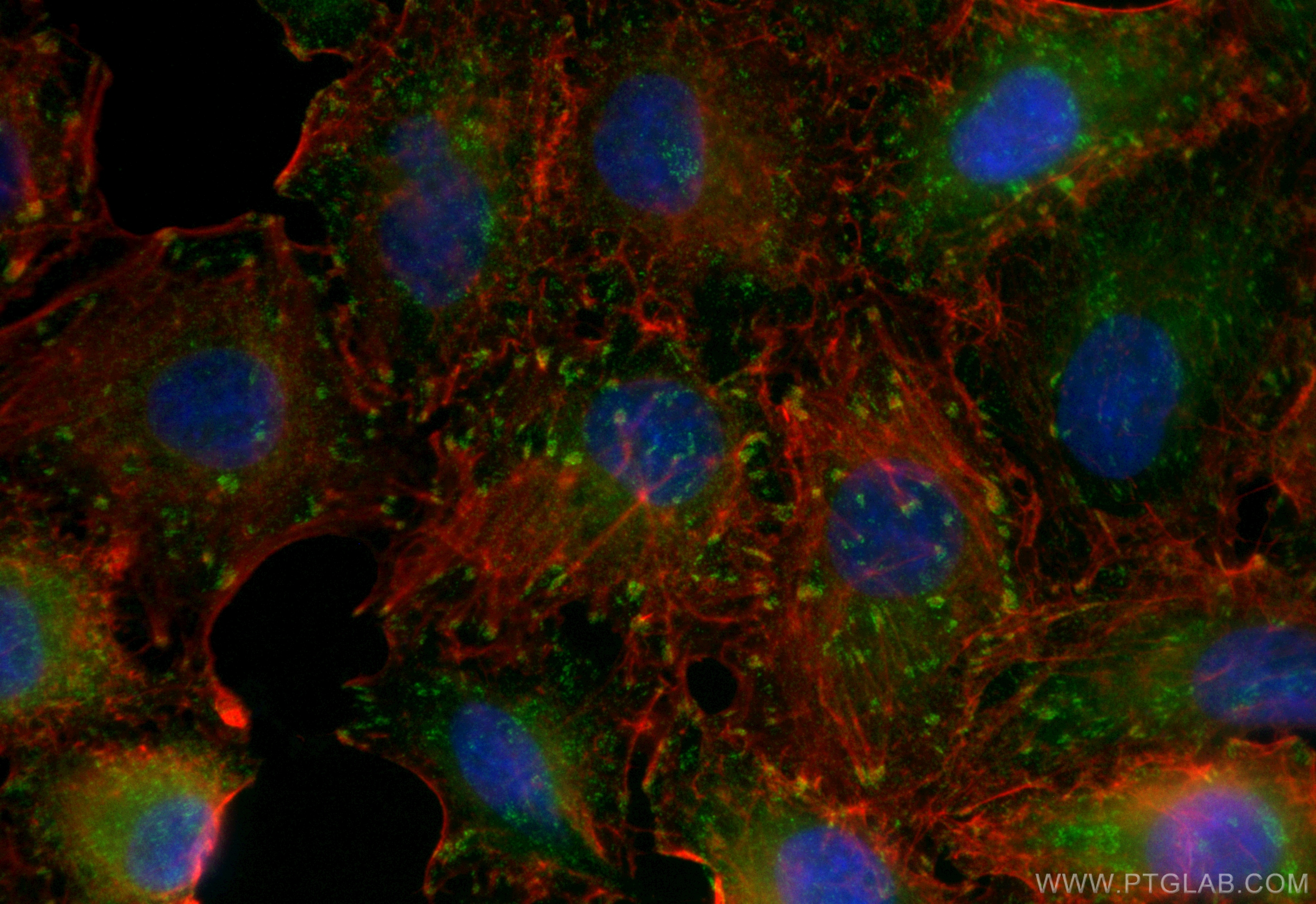 Immunofluorescence (IF) / fluorescent staining of A549 cells using CoraLite® Plus 488-conjugated Talin-1 Recombinant  (CL488-82856-18)