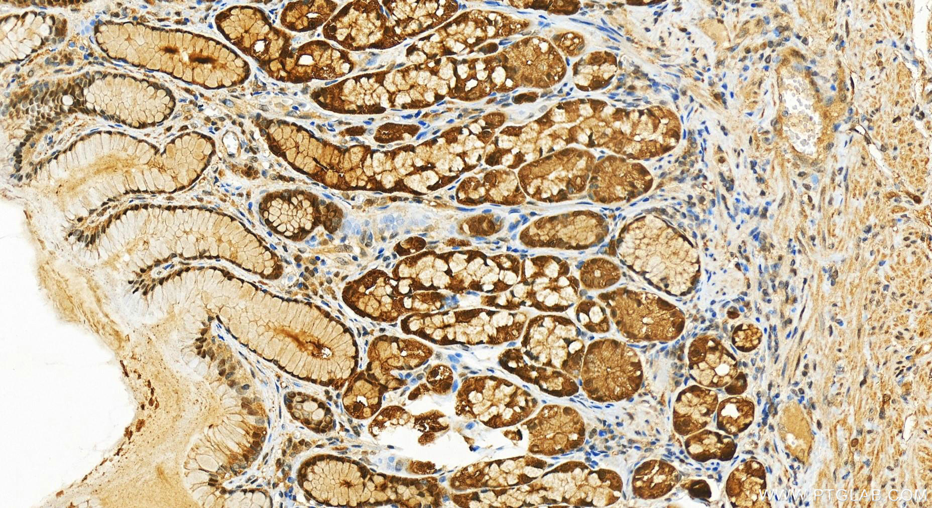 Immunohistochemistry (IHC) staining of human stomach tissue using Thioredoxin Recombinant antibody (82765-1-RR)