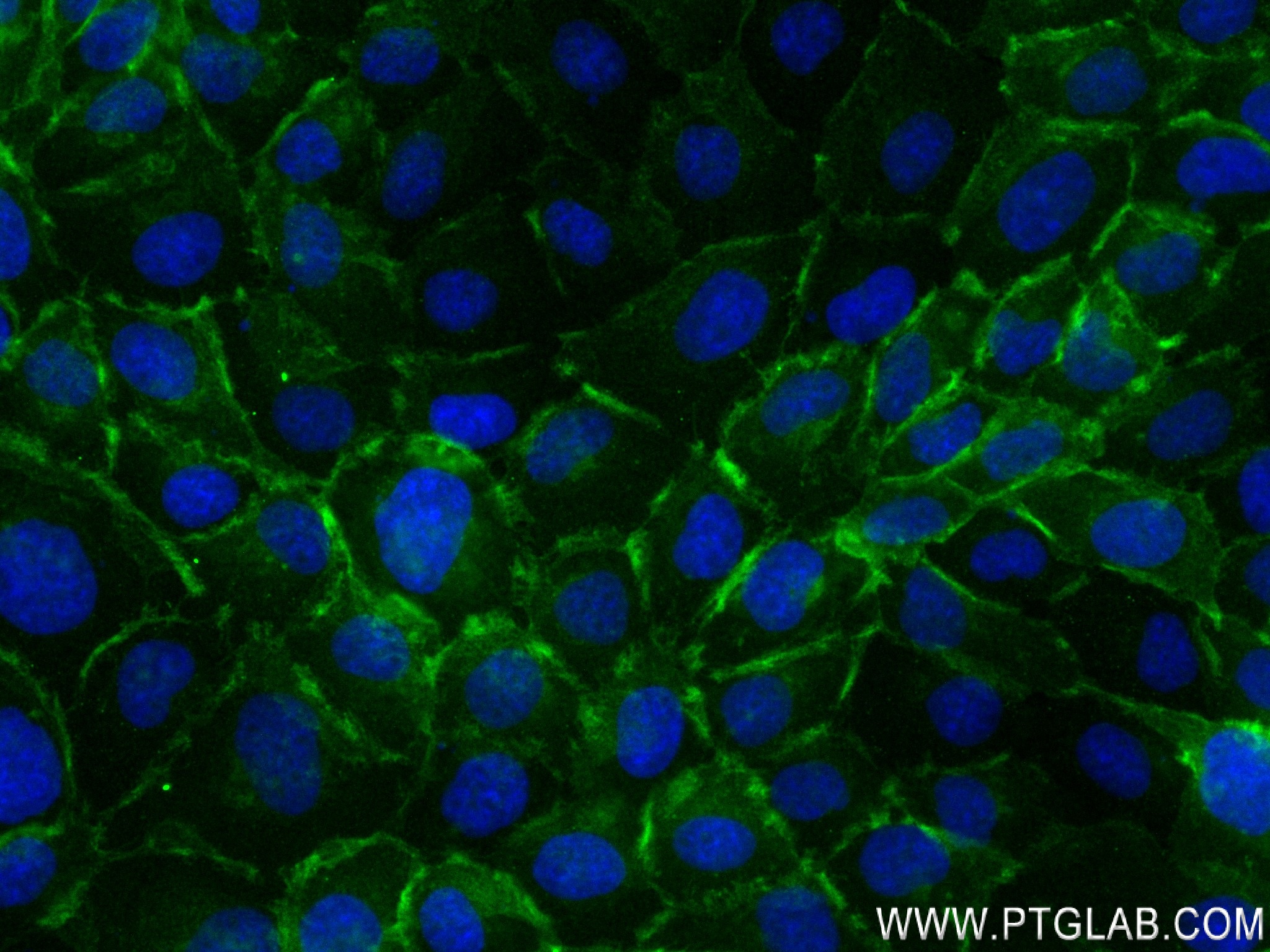 Immunofluorescence (IF) / fluorescent staining of A431 cells using Thrombomodulin Recombinant antibody (83416-4-RR)