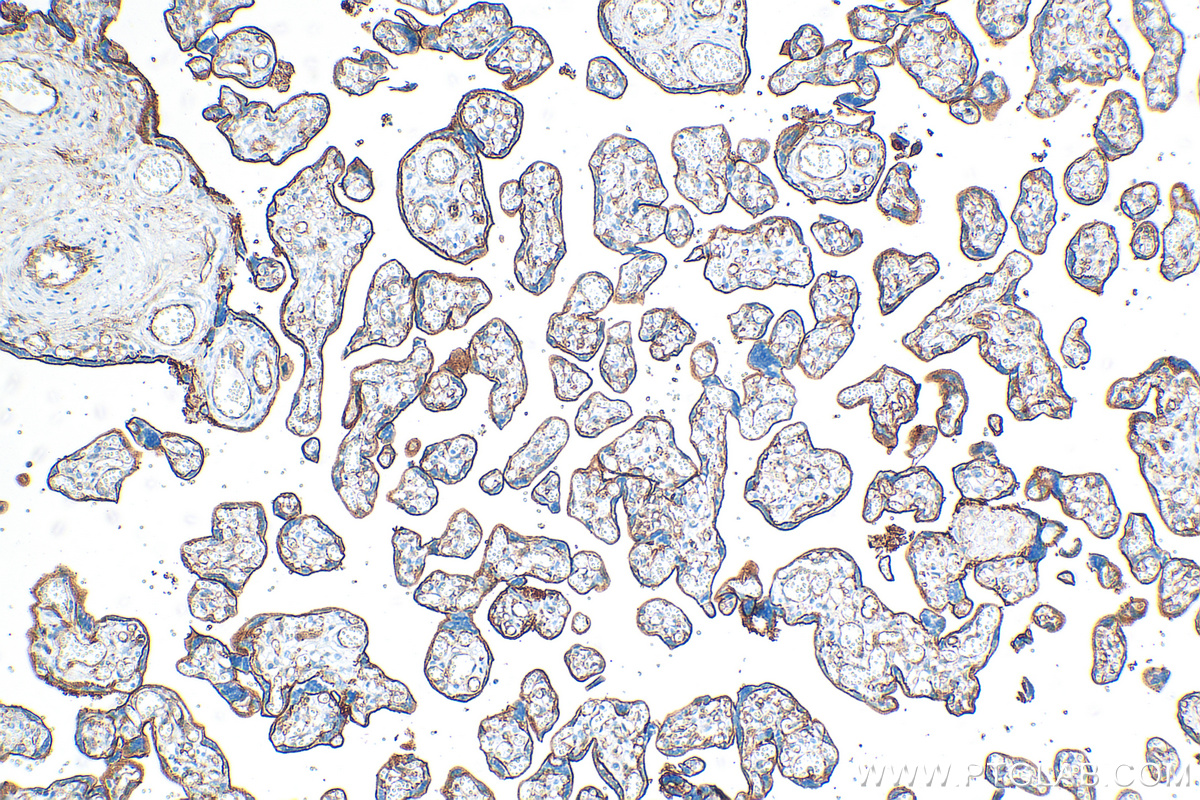 CD141/Thrombomodulin