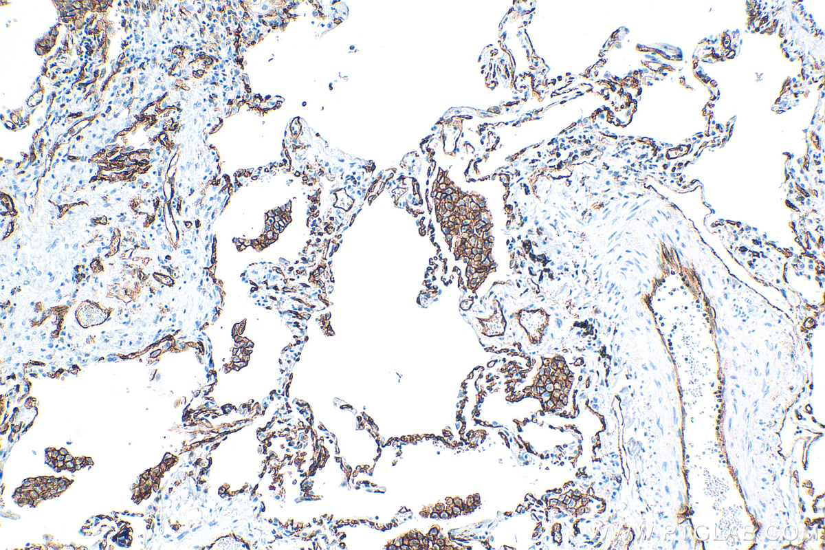 Immunohistochemistry (IHC) staining of human lung tissue using CD141/Thrombomodulin Recombinant antibody (83416-4-RR)