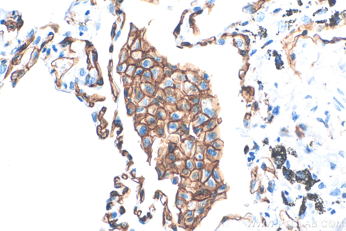 Immunohistochemistry (IHC) staining of human lung tissue using CD141/Thrombomodulin Recombinant antibody (83416-4-RR)